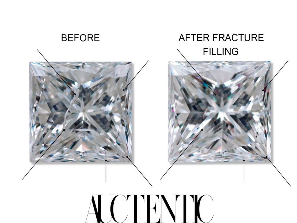 Fracture filling, before and after